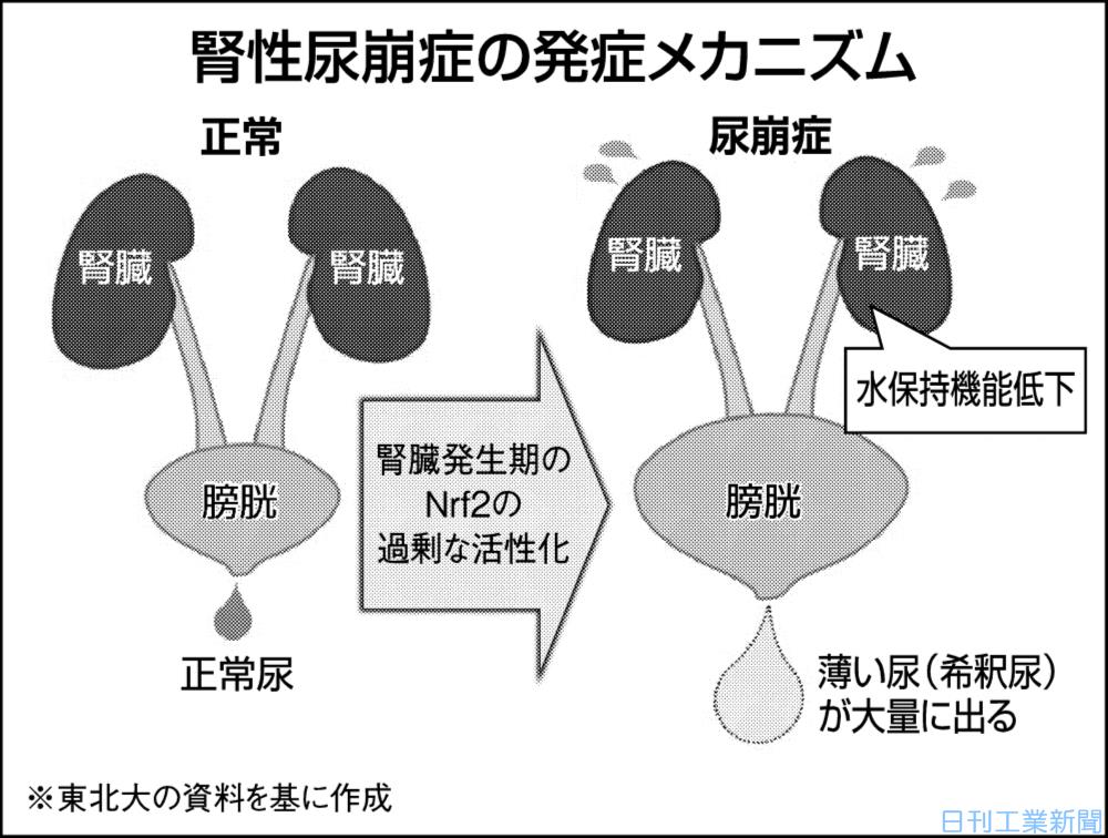 尿崩症は糖尿病と同じですか?