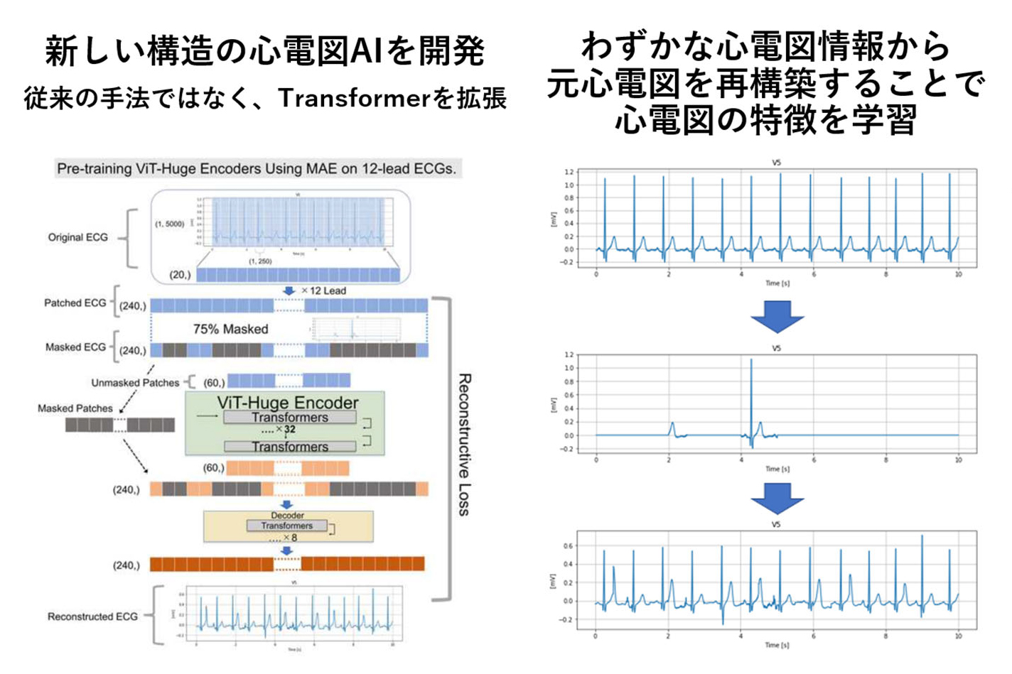 AIで心電図解析、東大が新手法 限られたデータから心機能低下を高精度