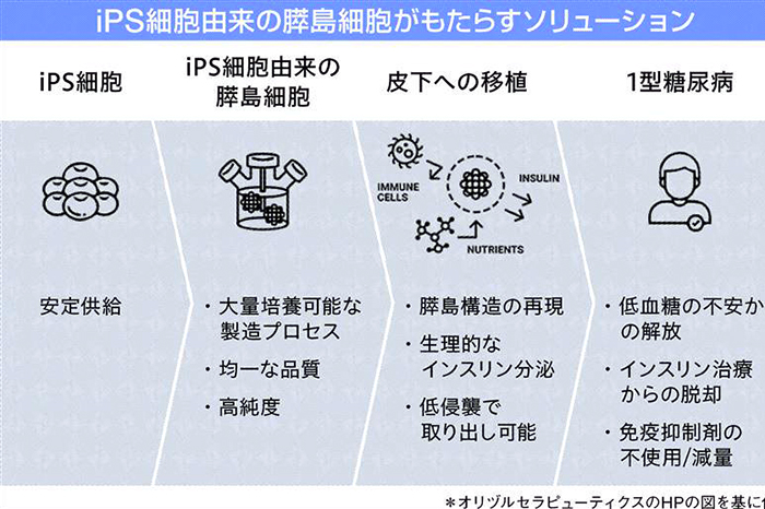 京都大学、糖尿病患者にiPS膵島細胞 30年代実用化へ インスリン注射