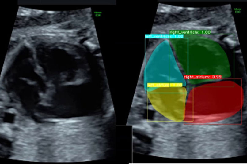 【裁断済】小児神経の画像診断 = Diagnostic Imaging of I カナデビア、AIで胎児の不整脈診断を支援 | 日刊工業新聞 電子版
