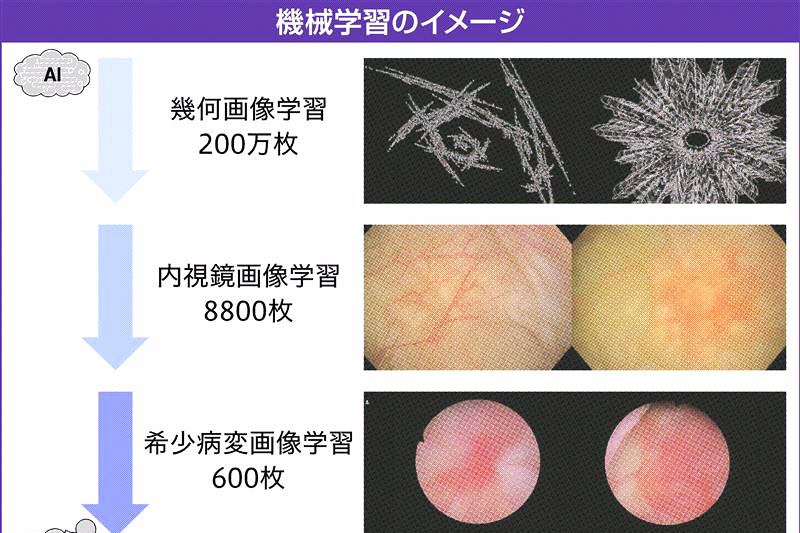 産総研・厚労省研究班、AIで希少難病の診断支援 人工データで精度
