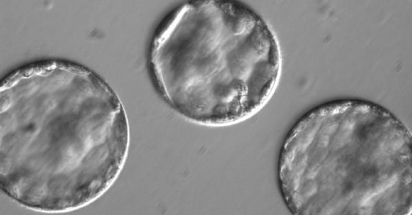 ヒトゲノムの分子遺伝学 MEDSi)株式会社 メディカル・サイエンス・インターナショナル